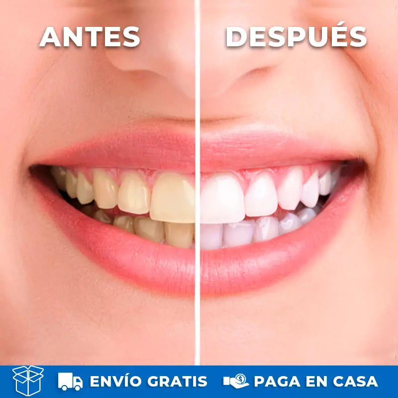 Irrigador Bucal Recargable