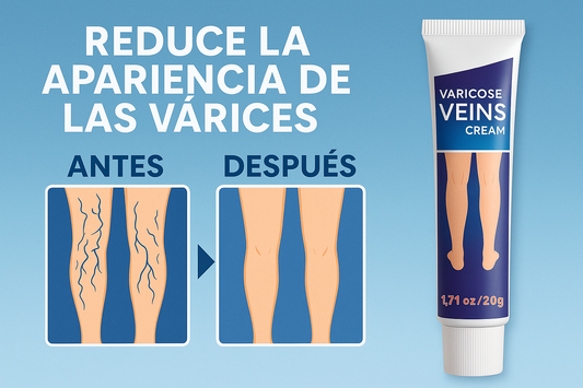 Crema para varices